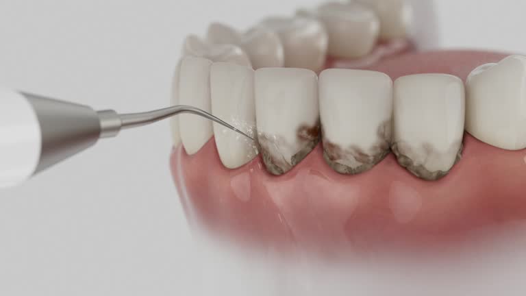 Trusted Teeth Cleaning And Checkup service in Wilton Manors, FL - Dentist Open Now